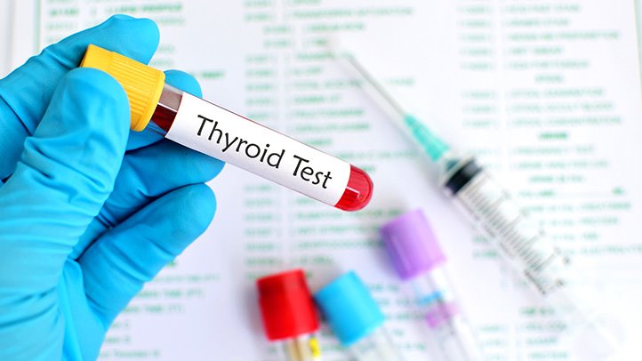 How To Cure Thyroid Permanently