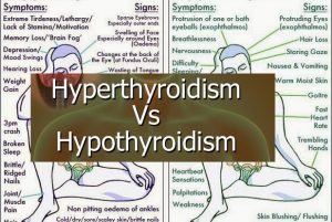 Hyperthyrodism vs hypothyroidism