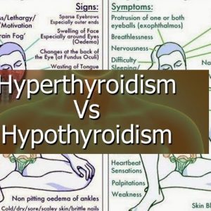 Hypothyroidism in Children | Symptoms Of Hypothyroidism In Children