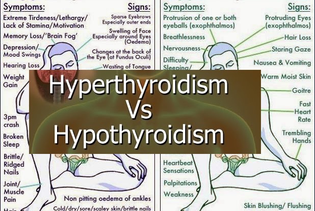 Hyperthyroid Vs Hypothyroid Symptoms Chart